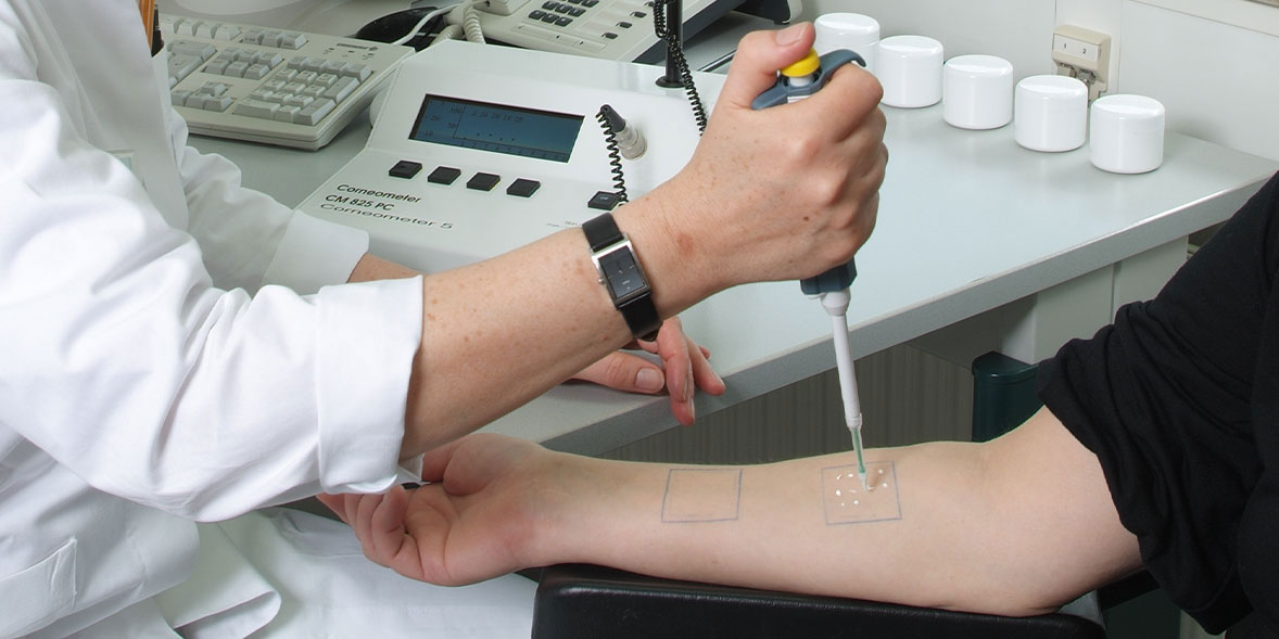 Suncream being tested on a volunteer
